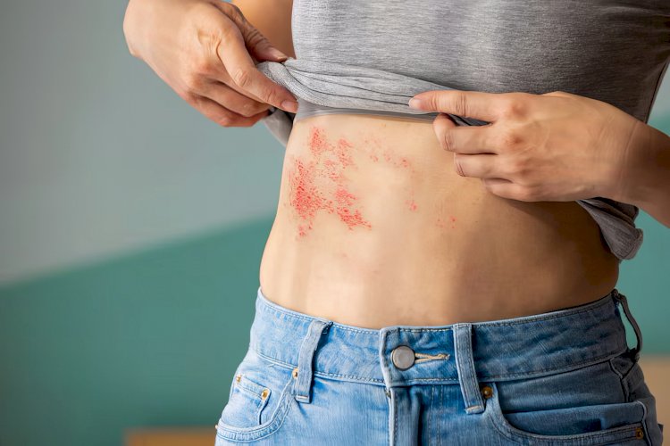 Brüksel ve Leuven Üniversite hastanelerinde hızlı dermatolog randevusu için ekstra ücret